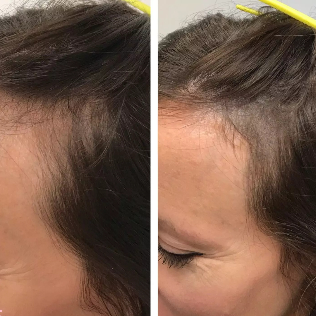 ReNuStrand™ Hair Growth Gummies