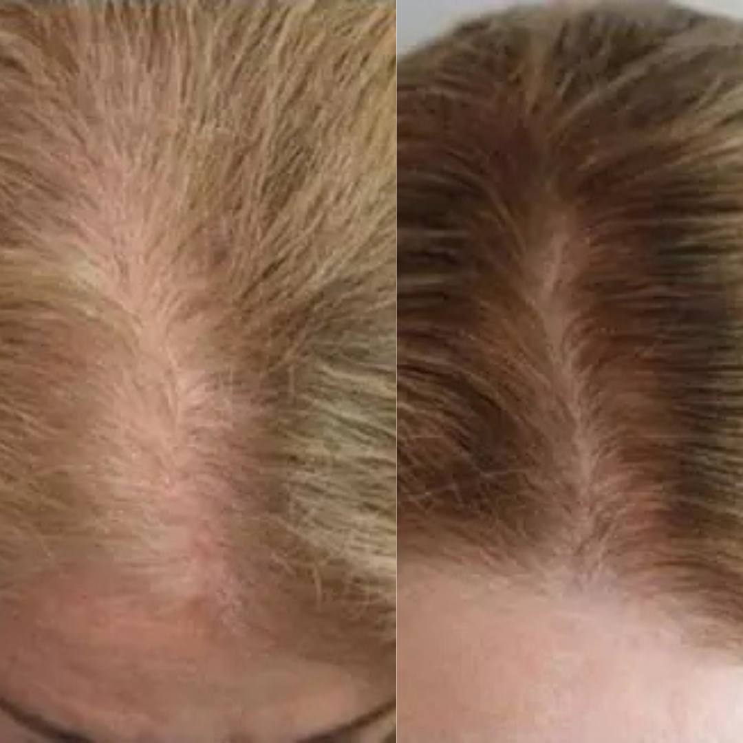 ReNuStrand™ Hair Growth Gummies